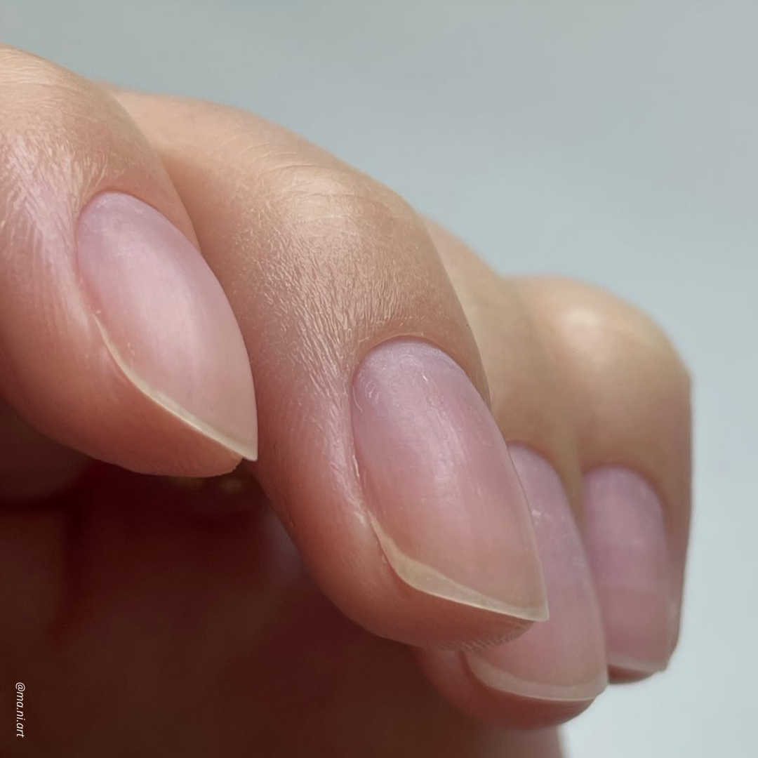 Common Nail Problems and What Causes Them
